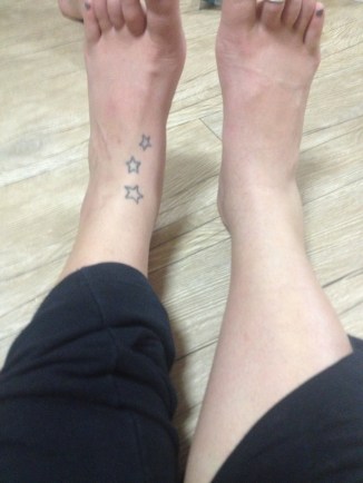 That fat right ankle...yikes!