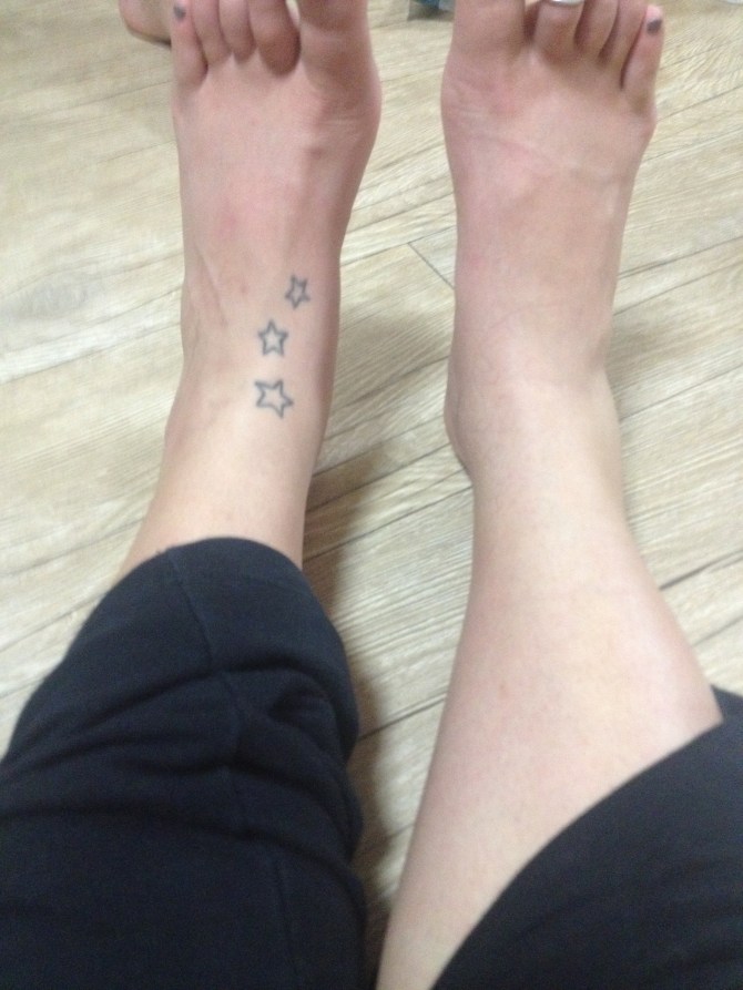 That fat right ankle...yikes!